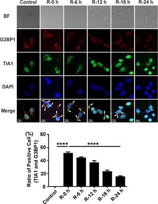 RNA Binding Protein Motif 3 Inhibits Oxygen-Glucose Deprivation/Reoxygenation-Induced Apoptosis Through Promoting Stress Granules Formation in PC12 Cells and Rat Primary Cortical Neurons
